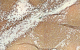 Human Tonsil: CD20 — Anti-Rabbit HRP (2)